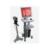 Video Colposcope