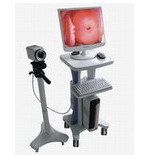 Video Colposcope