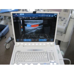 Sell Biosound MY LAB30 CV XView Color Doppler Ultrasound