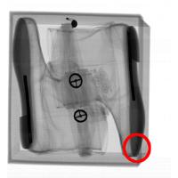 Xray Check