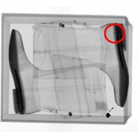 Xray Check