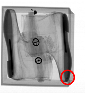 Xray Check