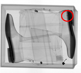 Xray Check