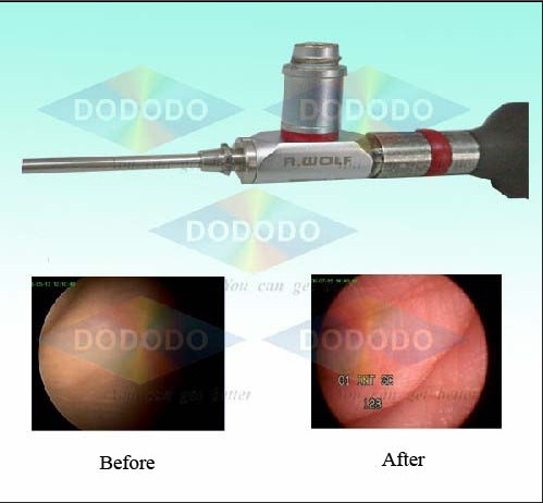Repair Rigid Endoscope (repair Wolf 25)